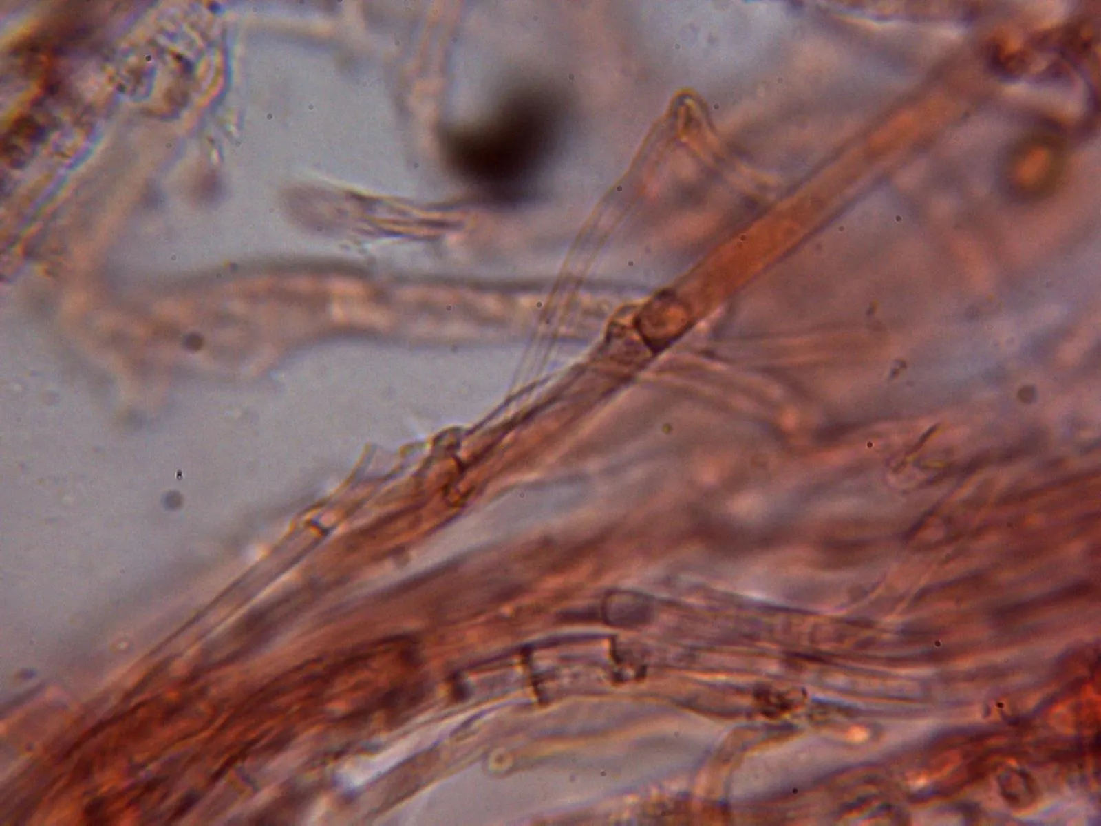 10 - Fíbulas pié